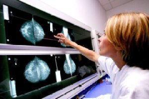 A radiologist studies mammograms for signs of breast cancer